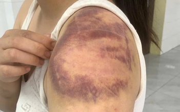 Tạm giữ hình sự đối tượng trói, đánh con ruột, hành hạ vợ mang thai