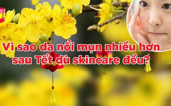 Vì sao da dễ nổi mụn sau Tết dù skincare rất kỹ?