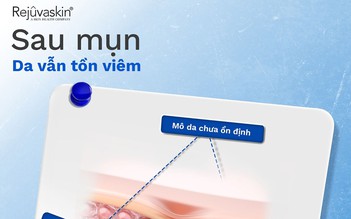 Những lưu ý chăm da sau mụn