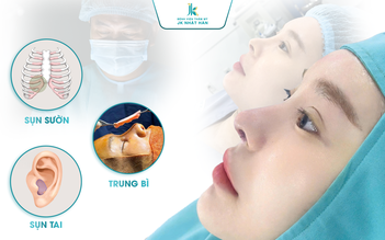 Nâng mũi thuần tự thân, giảm bóng đỏ, lộ sống, không lo sửa nhiều lần