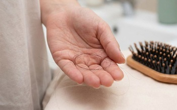 Chuyên gia: Muốn giảm rụng tóc, hãy chú ý những điều sau đây!
