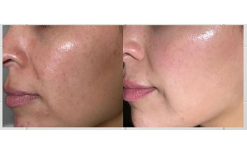 7 kem trắng da chống lão hóa giúp làn da tuổi 40 căng trẻ, mịn màng