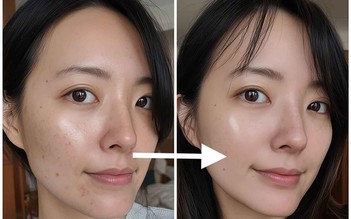 Bôi mãi kem mờ nám đắt tiền da vẫn sạm đen, thử ngay top 4 dưới đây!