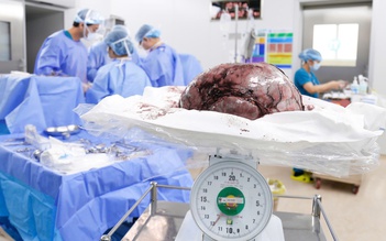 U xơ tử cung 12 kg, to như bụng mang song thai trong người cô gái trẻ