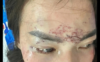 Đánh ghen, xăm lên mặt 'tình địch': 2 phụ nữ ở Cà Mau lãnh án tù