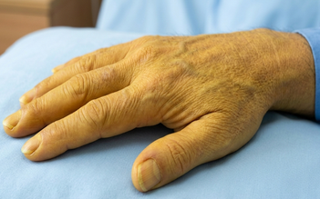 3 biểu hiện ở gan báo động nguy cơ đe dọa tính mạng