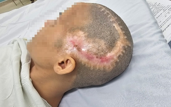 TP.HCM: Đột quỵ sau phẫu thuật thẩm mỹ hút mỡ bụng, cấy mỡ