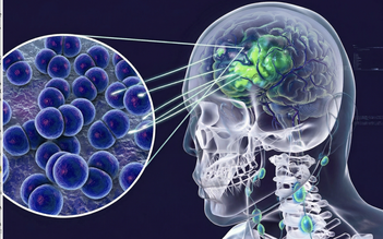 Viêm não mô cầu: Sau ca tử vong, 10 ngày qua Cà Mau chưa có ca mới