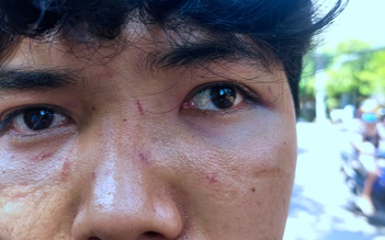 Hành hung người bán bánh bèo ở Quy Nhơn: Con trai cũng bị đánh