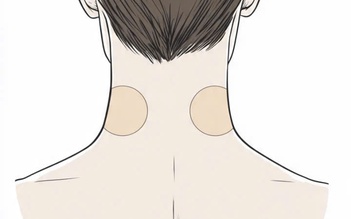 Bé gái 7 tuổi loạn thần cấp tính sau khi dùng miếng dán chống say tàu xe