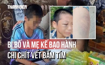 Toàn cảnh vụ bé trai nghi bị bố và mẹ kế bạo hành: Đã nhập viện với chi chít vết bầm tím