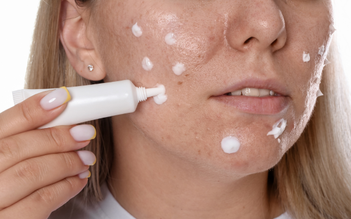 Vì sao nhiều người trị sẹo mãi không hiệu quả dù rất chăm skincare?