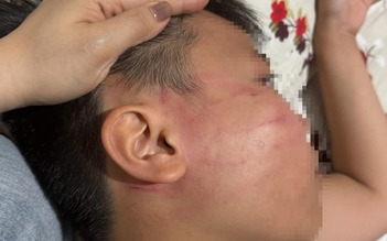 Thầy giáo người Ấn Độ bị tố tát học sinh lớp 4