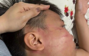 'Cát tát' của giáo viên nước ngoài