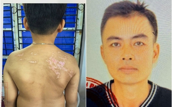 Phú Thọ: Bắt giam người cha đánh đập con trai dã man