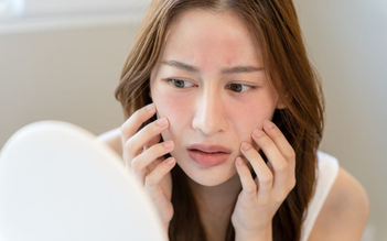 Vì sao cùng một chu trình nhưng da vẫn breakout khi hè đến? Giải đáp với Trioderma