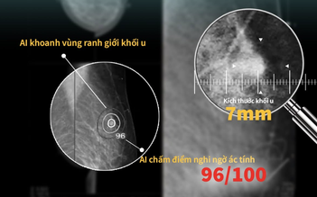 Dự báo nguy cơ tim mạch 10 năm: Bước tiến mới của y học ứng dụng AI