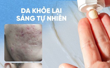 Review chi tiết kem Scar Esthetique làm mờ sẹo rỗ do mụn có tốt không?