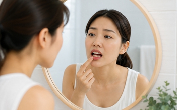 Bác sĩ ‘chỉ điểm’ 4 thói quen âm thầm gây hại răng miệng