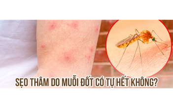 Bị sẹo thâm do muỗi đốt và côn trùng cắn có trị hết được không?