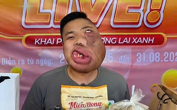 Từ người 'mặt quỷ' thành KOC truyền cảm hứng