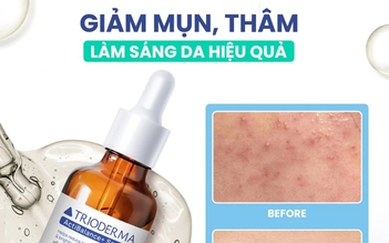 Serum giúp ngừa mụn, sáng da Trioderma ActiBalance+ Serum có tốt không mà ‘cháy hàng’ liên tục? Serum giúp ngừa mụn, sáng da Trioderma ActiBalance+ Serum có tốt không mà ‘cháy hàng’ liên tục?