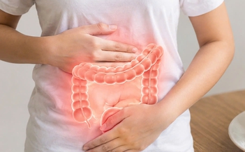 Thói quen giúp giảm nguy cơ ung thư đại tràng