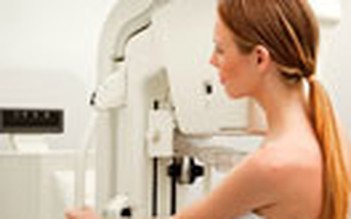 Hạn chế chụp ảnh y khoa để giảm ung thư vú