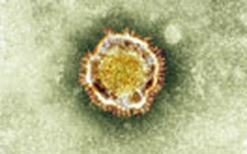Thêm 5 người tử vong do virus giống SARS