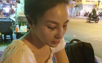 Xót xa trước ảnh Hoa hậu Việt Nam thế giới bầm dập vì bị đánh