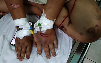 Thai phụ 18 tuổi bị hành hạ dã man: Lấy lời khai người đem thai nhi đi bỏ