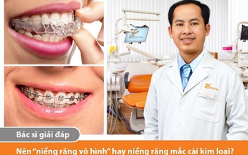 Nên ‘niềng răng vô hình’ hay ‘niềng răng mắc cài kim loại’ ?