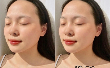 Sở hữu làn da trắng sáng, mịn màng cùng Lam Beauty Clinic