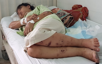 Lời kể rùng rợn của thai phụ bị giam cầm 20 ngày, bị đánh sẩy thai