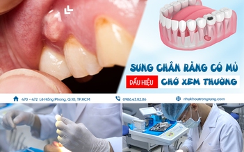 ‘Sưng chân răng có mủ’ dấu hiệu chớ xem thường