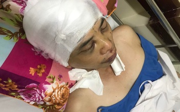 Hải Dương: Phó chủ tịch xã bị đánh vỡ hộp sọ khi làm nhiệm vụ đã hồi tỉnh