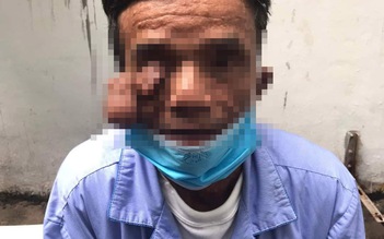 Quảng Bình: Cắt bỏ khối u 'đeo' trên mặt người đàn ông suốt 30 năm