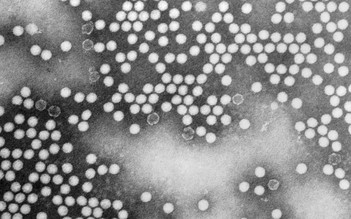 Mỹ ghi nhận ca bệnh bại liệt đầu tiên trong gần một thập niên