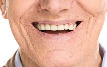Sức khỏe răng miệng không tốt ảnh hưởng tuổi già