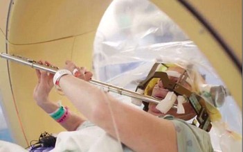 Bệnh nhân thổi sáo trong khi đang được phẫu thuật não