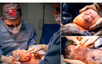 Ấn tượng hình ảnh cậu bé sinh ra còn nằm nguyên trong túi ối