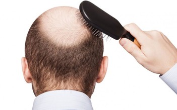 Những thói quen, lối sống gây tổn hại nghiêm trọng cho tóc