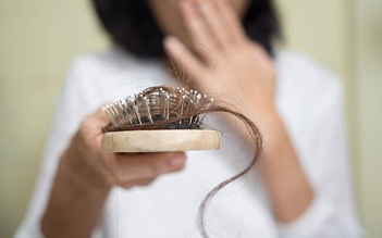 7 nguyên nhân khiến phụ nữ bị rụng tóc