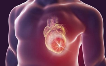 Cảnh báo triệu chứng thường gặp của đau tim nhưng ít người chú ý