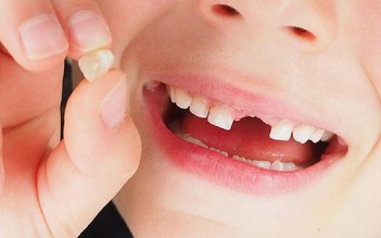 Bị gãy răng, bác sĩ phát hiện cậu bé 5 tuổi bị ung thư hiếm gặp