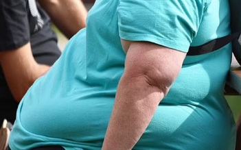 Giảm cân được 167 kg, người phụ nữ phải cắt bỏ 21 kg da thừa