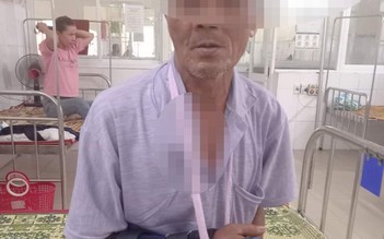 Quảng Trị: Người đàn ông 65 tuổi nhập viện vì bị khỉ tấn công