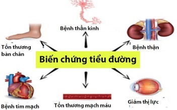 Phương pháp hỗ trợ giảm nguy cơ biến chứng do đái tháo đường