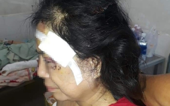 Phú Yên: Điều tra vụ chồng đánh vợ cũ bị thương
