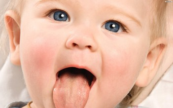 Trẻ sinh thường dễ bị nấm lưỡi!